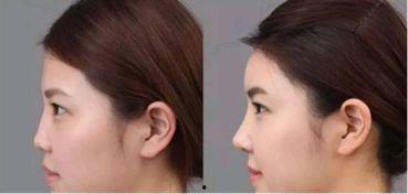 明星脸养成,揭秘变身明星之路